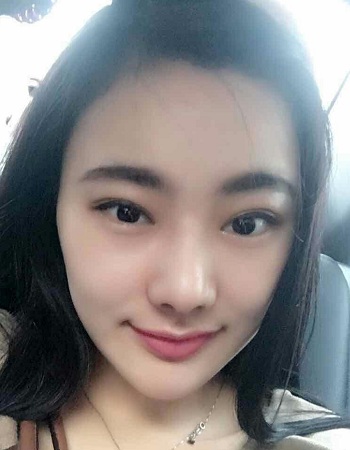 美萊案例劉雨婷對比圖后