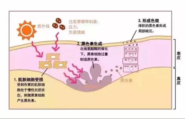 皮膚太黑怎么改善