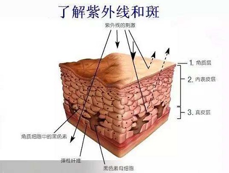 激光祛日曬斑費(fèi)用多少