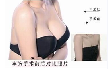 有什么辦法讓乳房變美呢？