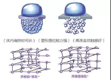 玻尿酸為什么維持時間短？