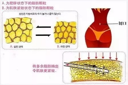 四月不吸脂，五、六、七月徒傷悲......