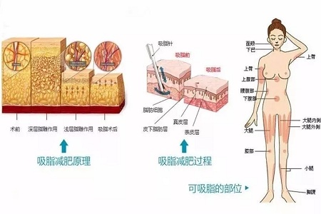 四月不吸脂，五、六、七月徒傷悲......