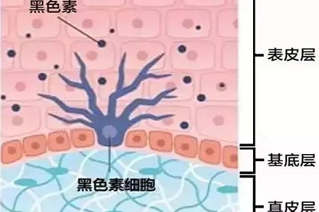 祛斑偏方“害死人”，小仙女們可長點心吧！