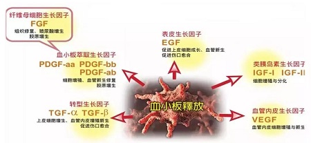 PRP自體基因再生技術