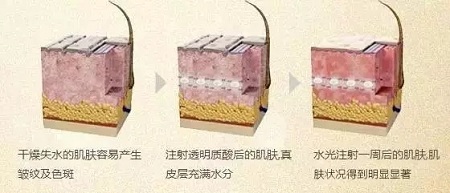 水光，打1次和4次究竟有多大區別？