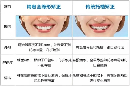 這種牙齒矯正方式，96%的人都會選擇！