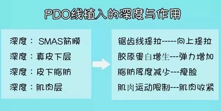 關(guān)于*雕，你想了解的都在這里！