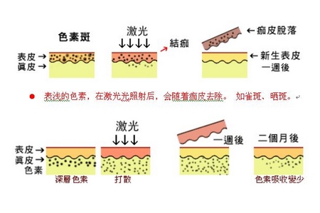 祛斑方法有哪幾種？這些祛斑小妙招你需要掌握