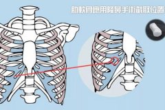 深圳隆鼻醫院做軟骨隆鼻多少錢，術后安全嗎